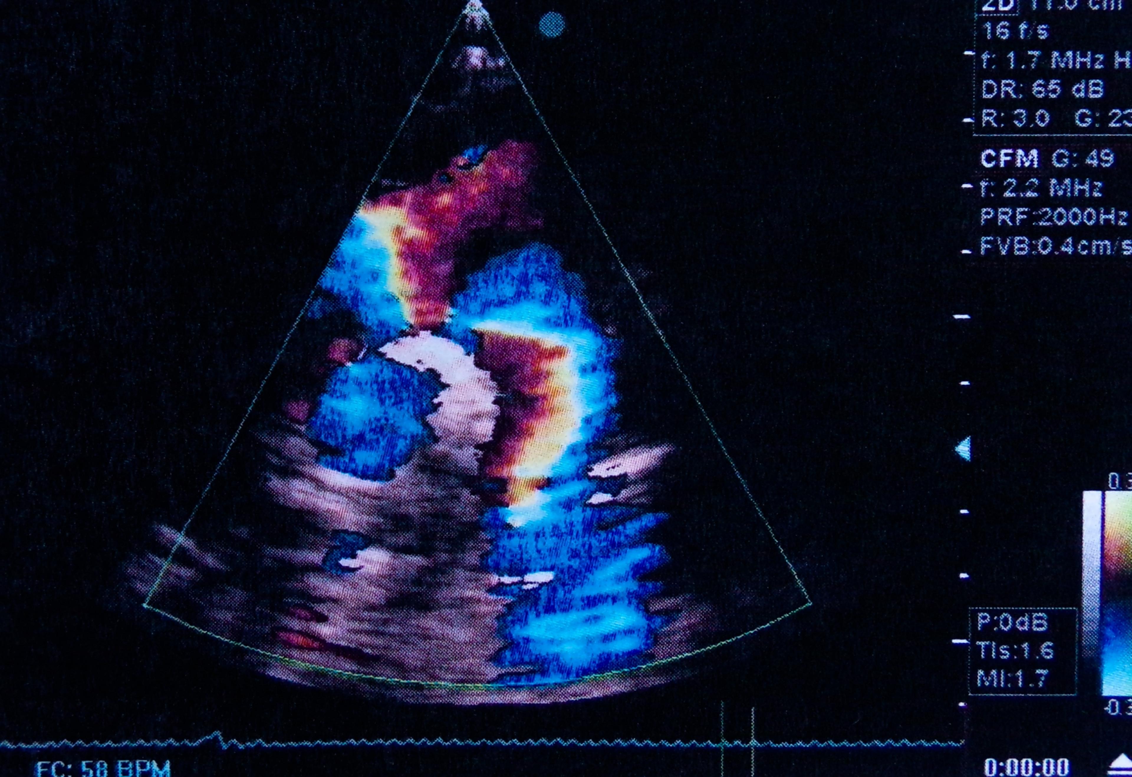 Diagnostic diagnostic